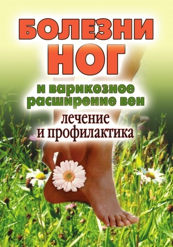 Болезни ног и варикозное расширение вен. Лечение и профилактика